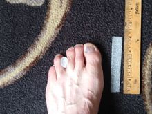 relief cushion for Morton's Neuroma