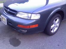 Side Face - Before