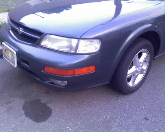 Side Face - Before