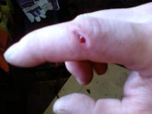 Finger gouged with body grinder...blood, sweat and tears!