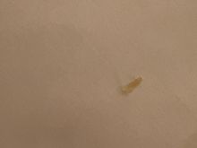 Toenail? Wasn’t sure