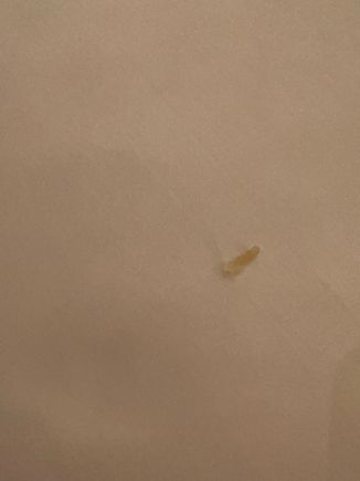 Toenail? Wasn’t sure