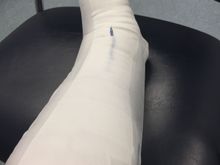 Ouch!