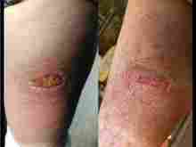 Comparing burn marks