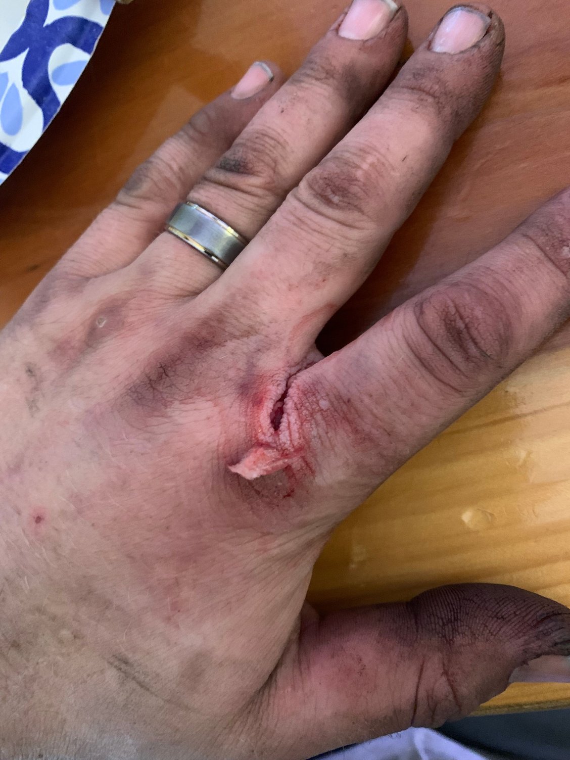 Gashed this thing at pick a part on a mls exhaust gasket. Didn�t even feel it just started leaking like a faucet. 