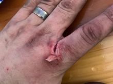 Gashed this thing at pick a part on a mls exhaust gasket. Didn’t even feel it just started leaking like a faucet. 