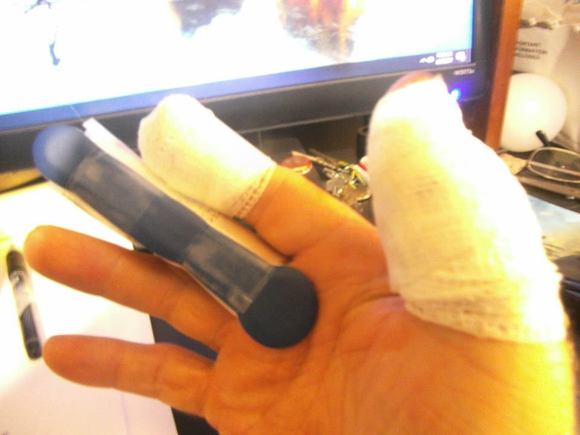 27 stitches and it was done by an OS 62, not a Saito.