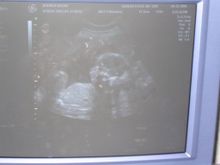 May 22nd 20weeks 14oz. it