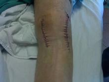 knee 3.jpg