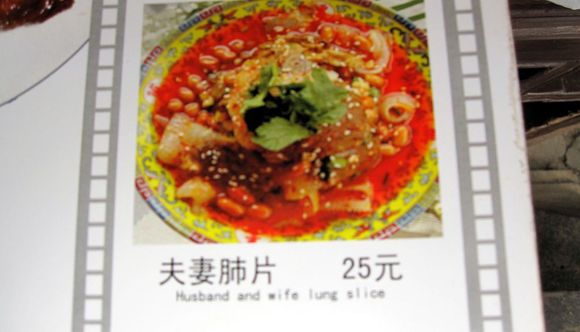 Husband and wife lung slice x.jpg